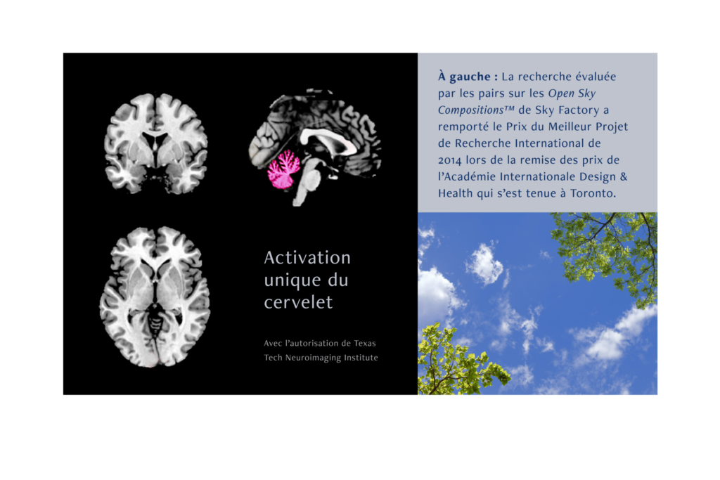 Brain cerebellum Scan FRENCH (2)